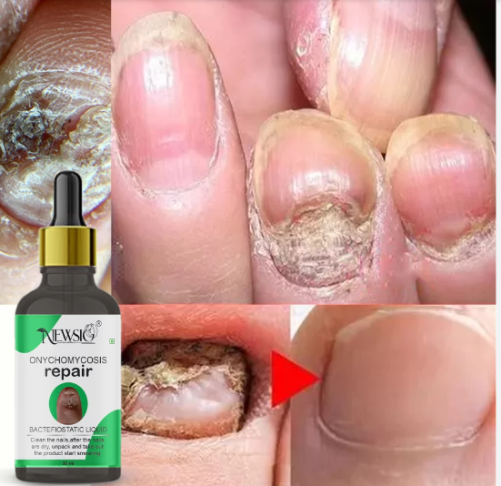 Старт в Facebook